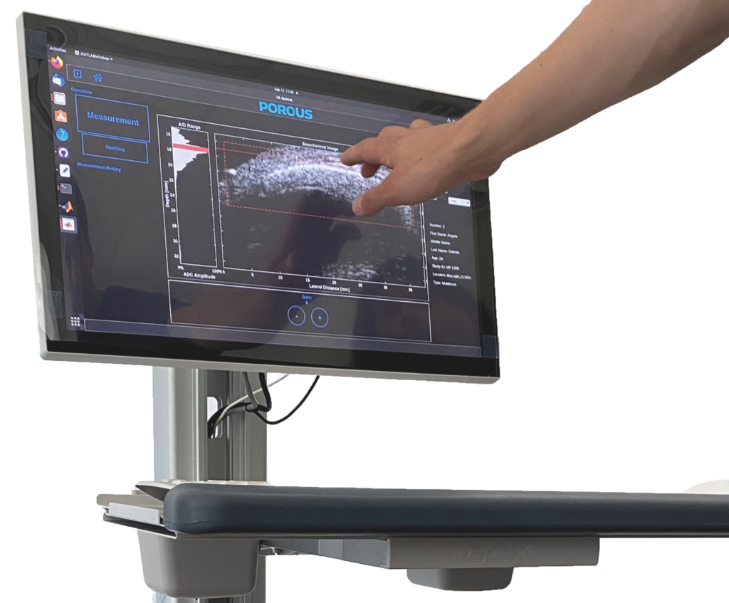 Ultrasound Bone Measurement