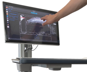 Ultrasound Bone Measurement